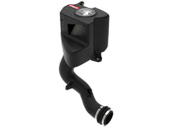 aFe Takeda Momentum Cold Air Intake w/ Pro DRY S Filter Subaru Forester XT 14-18 | 56-70049D